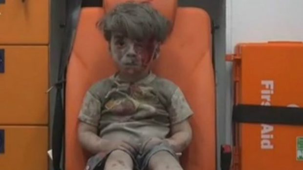 160818104423_omran_daqneesh_syria_640x360_aleppomediacenter_nocredit