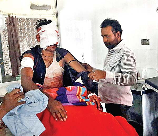3-4 भालुओं ने किया हमला, आंख बाहर निकाल ली