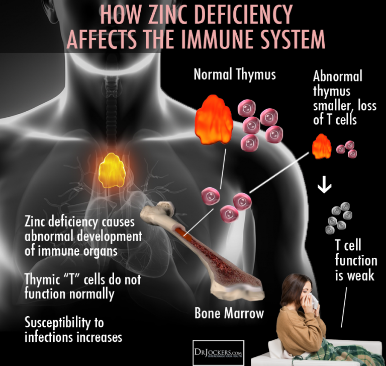 Zinc Deficiency in Humans affecting Immune System