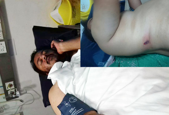 गैंगस्टर आजम के भाई को मारी गोली, फायर करने वाले में महिला शामिल – नहीं लगा कोई सुराग