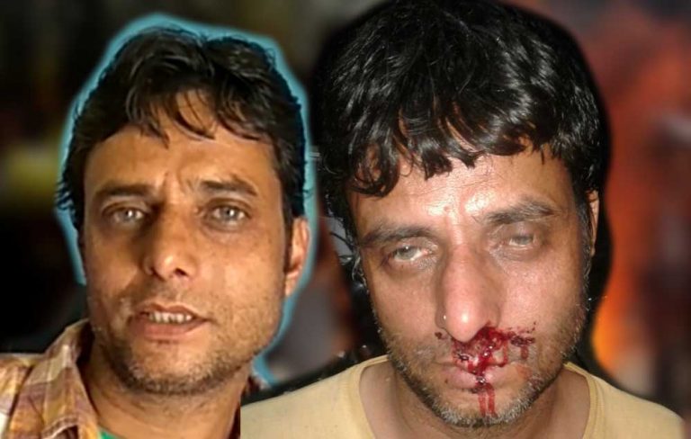 न्याय नहीं मिला तो गृहमंत्री कटारिया के सामने ही कर लूँगा आत्मदाह -लाखों की ठगी से कर्ज़दार हुए परेशान युवक “राजू” का दर्द