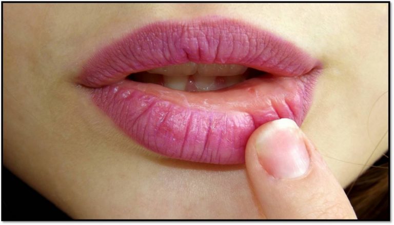 Kiss the Vaseline goodbye: 5 nice lip balms