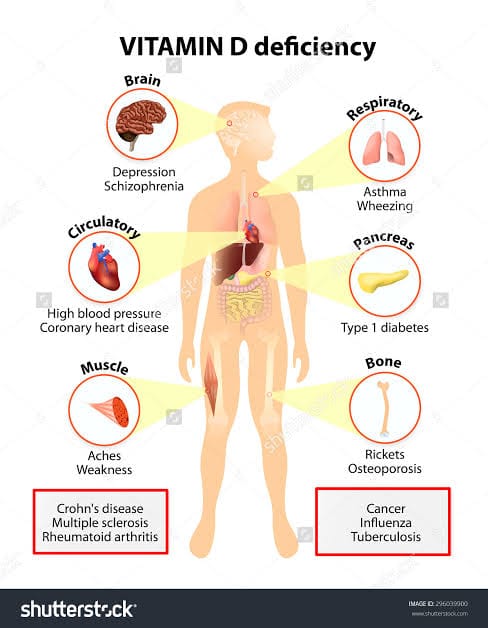 Vitamin D  Are you getting enough – Dr. Kajal Verma